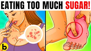 12 Major Warning Signs You’re Eating Too Much Sugar!