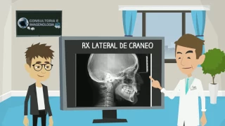 Rx  Lateral de Craneo