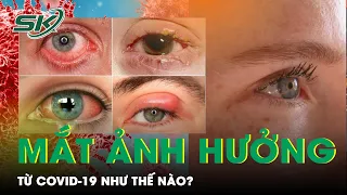 Mắt Chịu Ảnh Hưởng Như Thế Nào Từ COVID-19? | SKĐS