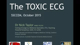 The Toxic ECG