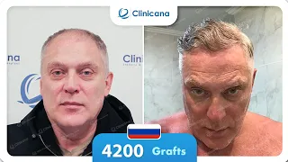 Oтличный результат в Clinicana,  Стамбул