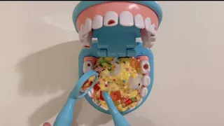 [💸Toy asmr💸] Dental care | Melissa and Doug Dentist kit 멜리사앤더그 치과 장난감 asmr
