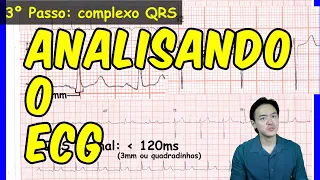 Eletrocardiograma - ECG em 5 passos