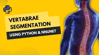 Vertabrae Segmentation using Python and nnUNetv2