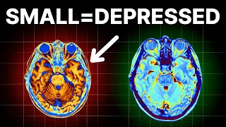 Not Growing Your Brain Makes You Depressed