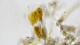 Golden Marine Diatoms of Bang Pu, Thailand