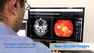 MILLENSYS Vendor Neutral Archive  "Vision Tools Workspace VNA / PACS"