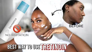 TRETINOIN / RETIN A - HOW TO USE TRETINOIN WITHOUT IRRITATION | SANDWICH METHOD