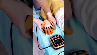 Soft hand rehabilitation robotic gloves for stroke patients.