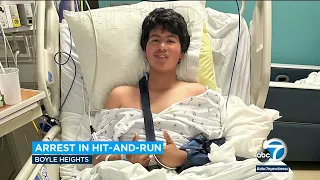 Arrest made after teen boy loses leg in Boyle Heights hit-and-run