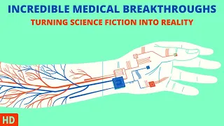 Medical Marvels: Astonishing Breakthroughs You Won't Believe