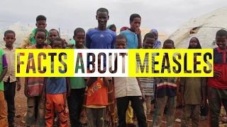 WHO Somalia: Facts About Measles