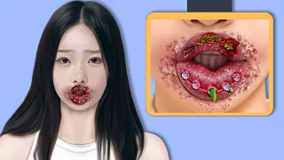 ASMR Removal Big Acne & Maggot Infected Dirty Lips| Severely Injured Animation
