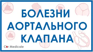 Болезни аортального клапана: аортальный стеноз, недостаточность аортального клапана.