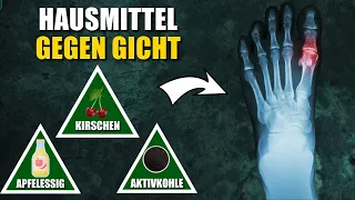 10 Natürliche Hausmittel gegen Gicht