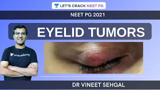 Eyelid Tumors |  NEET-PG 2021 | Vineet Sehgal