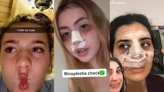 Nose job check (tik tok compilation)