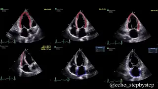 Cardiac Strain Imaging