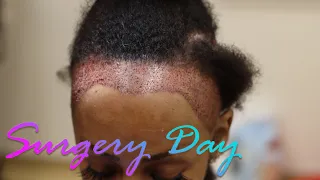 Hair Transplant Black Women - Halle's Surgery Day