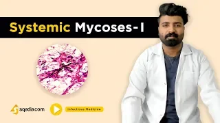 Systemic Mycoses -I | Infectious Medicine | Clinical Video Lectures | Medical V-Learning