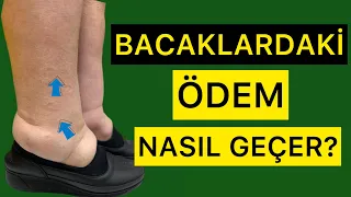 BACAKLARDAKİ ÖDEM NASIL GEÇER?-DOLAŞIMI ARTIR! #fizyoterapistmacide #ödem