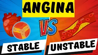 STABLE VS UNSTABLE ANGINA EXPLAINED IN 5 MINUTES | ANGINA PECTORIS | CORONARY ARTERY DISEASE