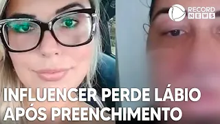 Influenciadora perde os lábios após preenchimento labial