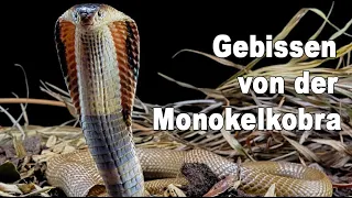 Erfahrungsbericht: Gebissen von der Monokelkobra | Kurzdoku Schlangenbiss