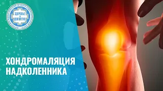 🦵 Хондромаляция надколенника или отсроченный гонартроз