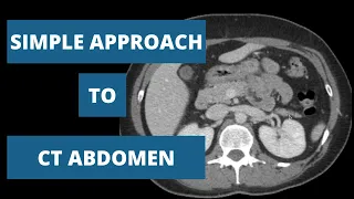 How to read a CT Abdomen - Part 2