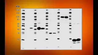 Western Blot: Conceptos Básicos