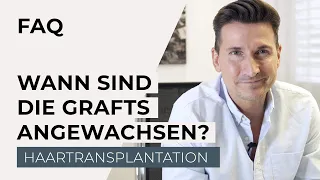 Haartransplantation - Wann sind die Haare fest angewachsen?