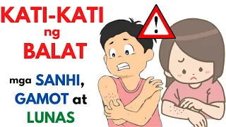 Gamot sa KATI KATI sa BALAT | Epektibong Ointment, Halamang Gamot at iba pa para sa makating BALAT