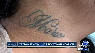 tattoo removal helps domestic abuse survivor move forward