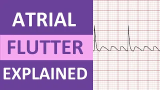 Atrial Flutter ECG: Causes, Treatment, Nursing NCLEX, ACLS Heart Rhythm Explained