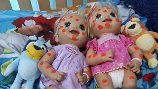 Baby Alive Learns To Potty Twins get  Sick with chicken pox ((remake))