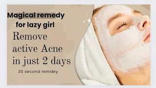 Remove active acne / acne spots / Mayisha world