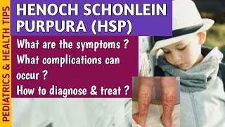 Henoch Schonlein Purpura (HSP) Causes, Symptoms, Diagnosis & Treatment In Pediatrics