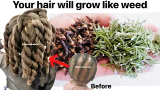 Clove & Rosemary spray for X10 hair growth. The only STRONGEST potent recipe EVER