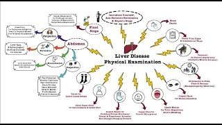 Liver Disease Physical Examination - OSCE