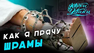 Как я перекрываю шрамы | Перекрытие шрамов татуировкой