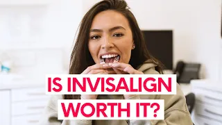 How much does INVISALIGN COST in the UK? Is Invisalign worth it?