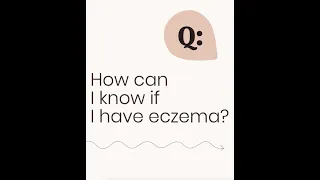 How can I know if I have eczema?