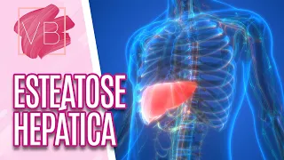 Alimentação e estratégias nutricionais para eliminar a esteatose hepática - Você Bonita (31/03/2022)