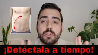 7 señales de que tu dolor de abdomen es apendicitis