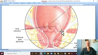 Anatomy GIT Module in Arabic  47 ( Anal canal, part 1 ) ,  by Dr, Wahdan