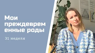 Мои преждевременные роды. Роды на 31 неделя. Неожиданный подарочек на новый год.