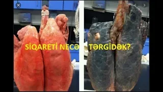 Satılan Siqaretlər Sonsuzluq Yaradır - Çünki Tərkibində...