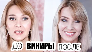 УЛЫБКА МЕЧТЫ✦ВСЯ ПРАВДА О ВИНИРАХ✦МОЯ ИСТОРИЯ✦ВИНИРЫ  И ИМПЛАНТАЦИЯ ЗУБОВ✦ТАТЬЯНА РЕВА