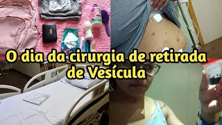 Cirurgia de Vesícula